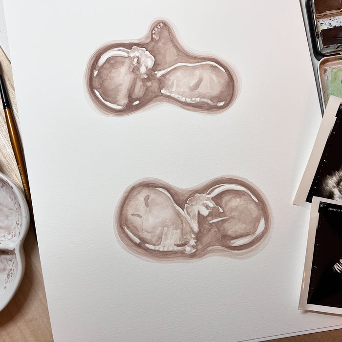 Sonogram Art -Siblings