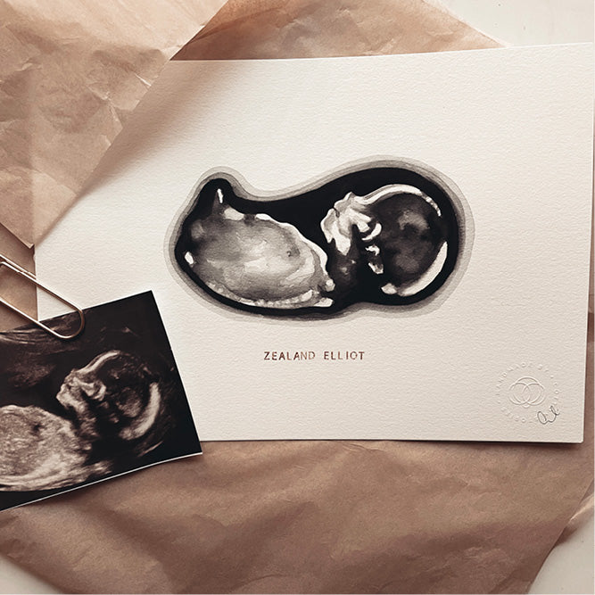 Sonogram Art